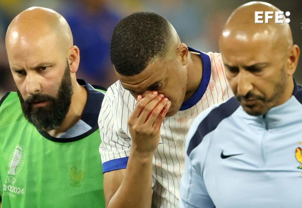 El francés Kylian Mbappé sufre fractura de nariz, como consecuencia del golpe sufrido en un choque fortuito con Danso en el partido que enfrentó a Austria contra Francia (0-1) en el debut de ambas selecciones en el grupo D de la Eurocopa. EFE/EPA/FRIEDEMANN VOGEL